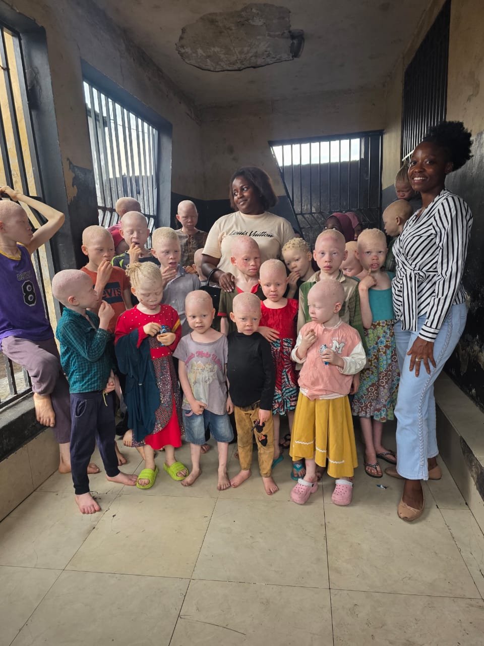 Soutien aux enfants atteints d’albinisme